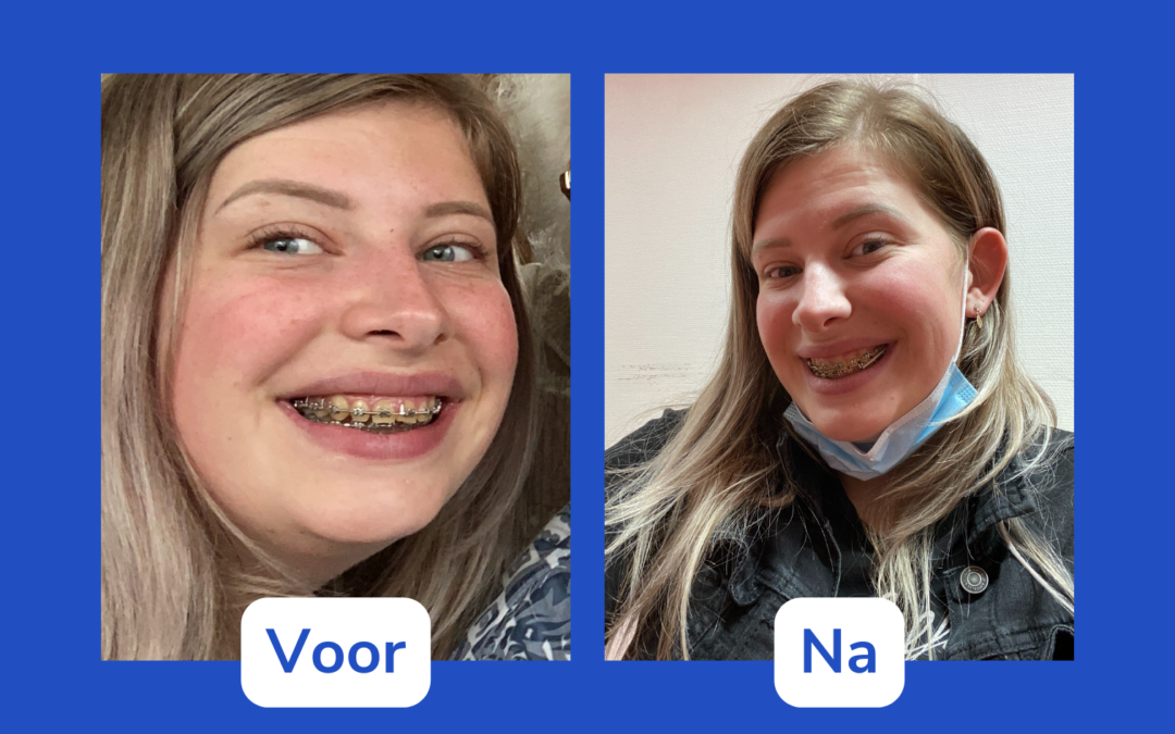 Saskia Beving “Ik was bang voor de narcose. Bang om niet meer wakker te worden”